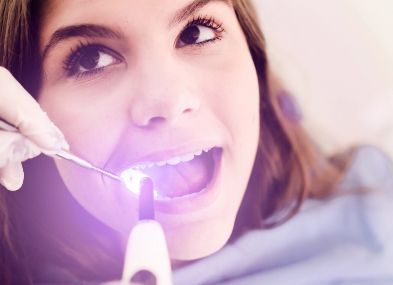 Glattflächen-versiegelung